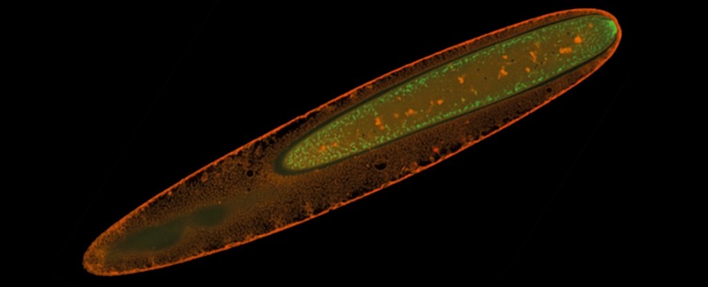 Giant Bacteria Visible to The Naked Eye Has a Never Before Seen Type of Metabolism ScienceAlert