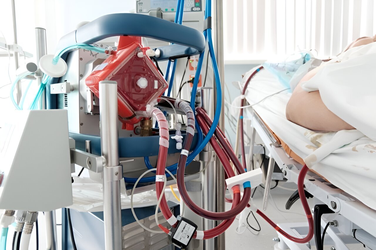 Prone positioning does not cut time to weaning in ARDS with VV ECMO