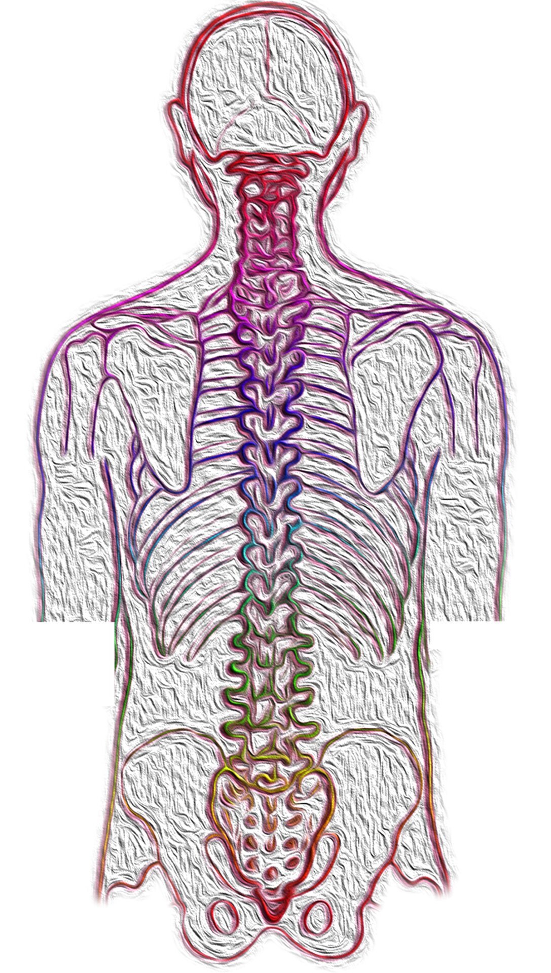 A call for comprehensive scoliosis awareness and care