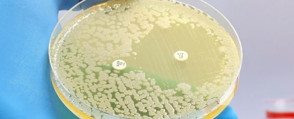 Gut Bacteria Is Surprisingly Resilient to Antibiotics, Long-Term Study Shows : ScienceAlert