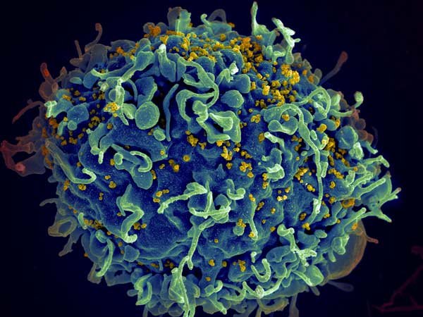 Higher viral load during HIV infection can shape viral evolution