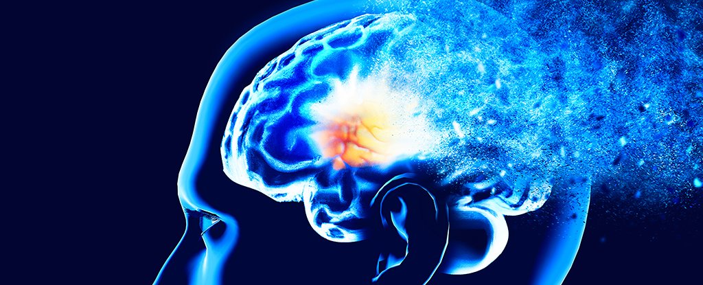 Major Study Identifies 15 Factors Linked to Early Dementia Risk : ScienceAlert