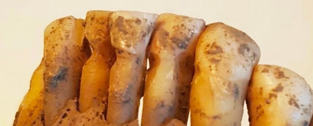 Scientists Studied 3,000 Viking Teeth And Discovered Surprisingly Advanced Dentistry : ScienceAlert