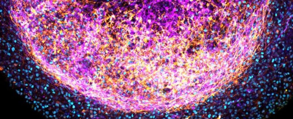 This Mini Brain Is Made From Real Tissue