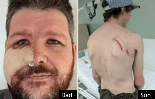 ‘A bear chewed my face off – so I ATE it’, says hunter mauled by beast before son punched it allowing him to open fire