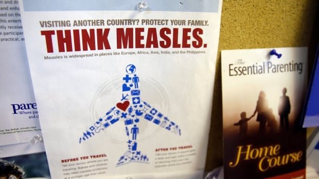 Make sure you have 2 measles shots before you travel on spring break, says Canada’s top doctor