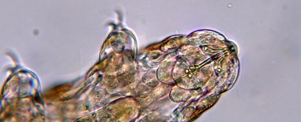 Tardigrade Genes Reveal a Strange History of Their Crazy Survival Skills : ScienceAlert
