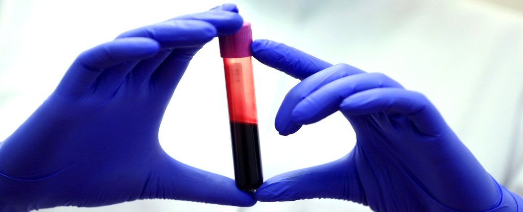 A Blood Test Could Reveal Your Biological Age And Predict Disease Risk : ScienceAlert