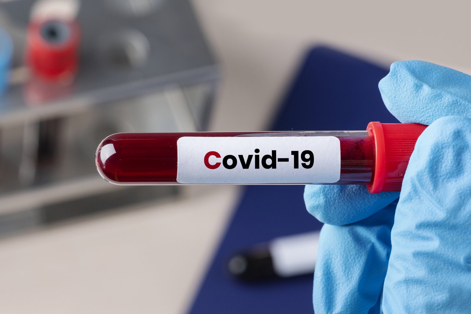 COVID-19 Virus Lingers In The Body More Than A Year After Infection: Studies