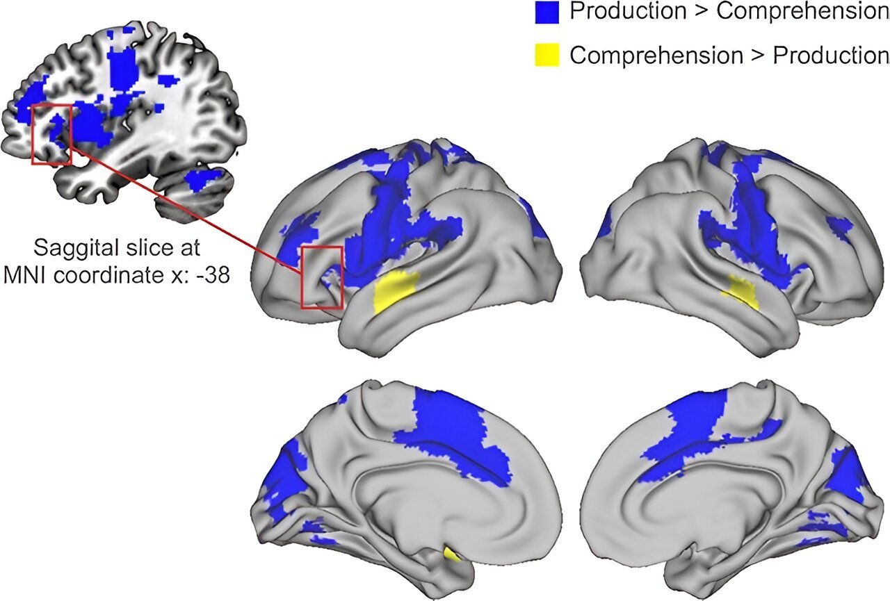 Functional MRI scans provide a novel view of the brains language network during conversation