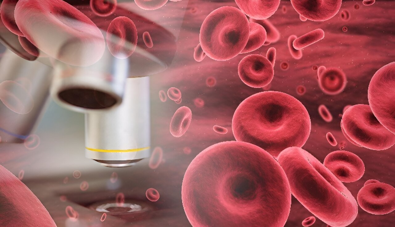 Iptacopan improves hematologic clinical outcomes in persistent anemia