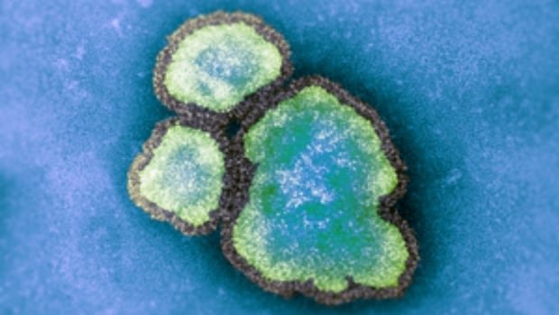 Measles may be spreading in some Canadian communities, officials warn