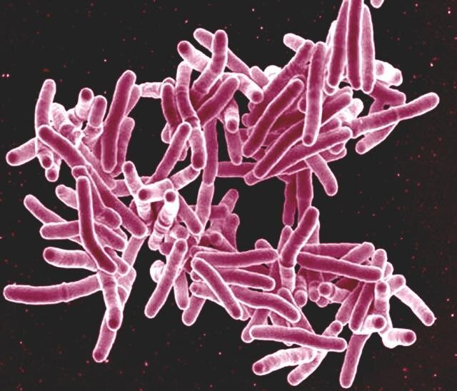 New classification of tuberculosis to support efforts to eliminate the disease