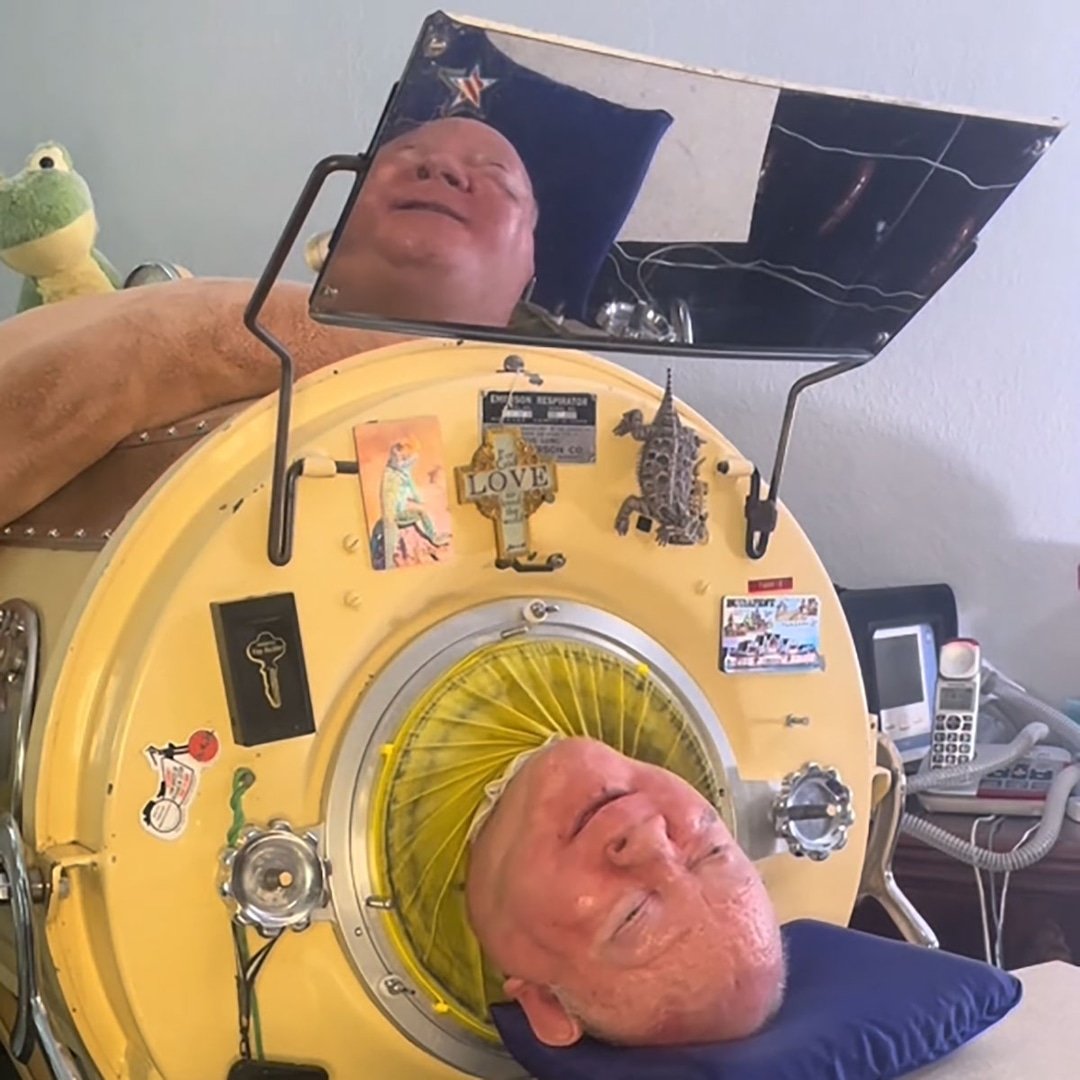 Paul Alexander Who Spent 70 Years in an Iron Lung Dead at 78