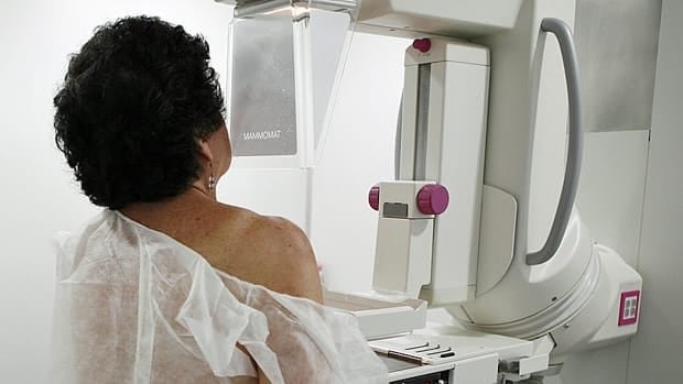 Quebec expands referral free breast cancer screening to 70 to 74 year olds