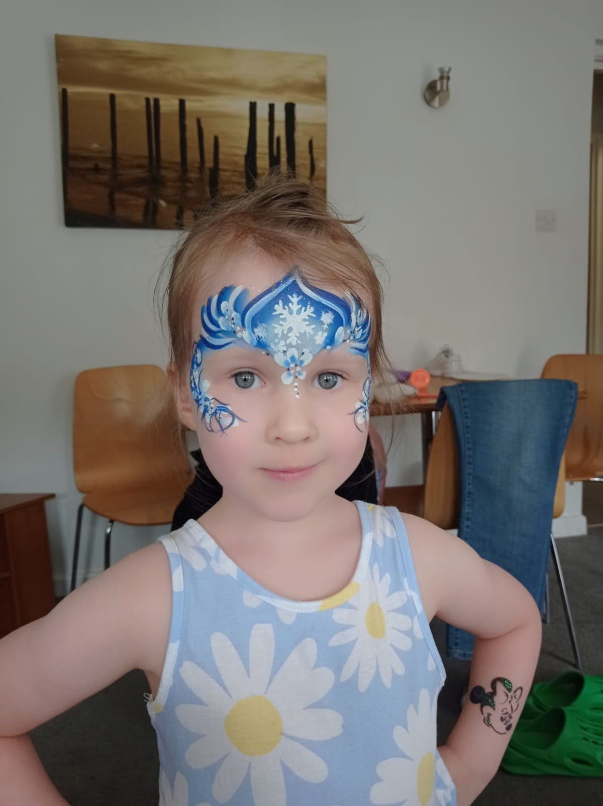 Four-year-old girl left with untreated glue ear and hearing loss for over year after being left untreated in Basildon Essex