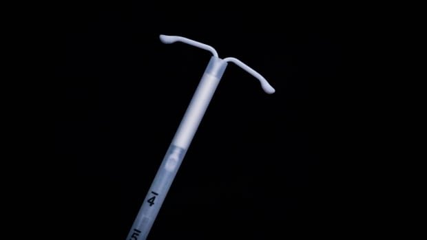 Some US clinics offer routine sedation for IUD pain saying it shouldnt feel traumatizing