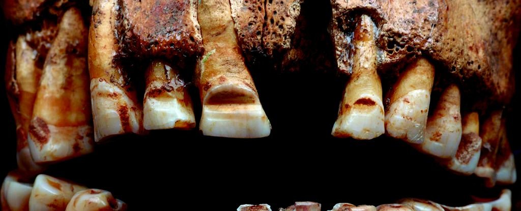 Vikings Filed Grooves Into Their Teeth as an Unusual Form of ID : ScienceAlert
