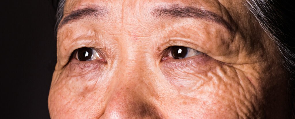 Your Vision Can Predict Dementia 12 Years Before Diagnosis, Study Finds : ScienceAlert