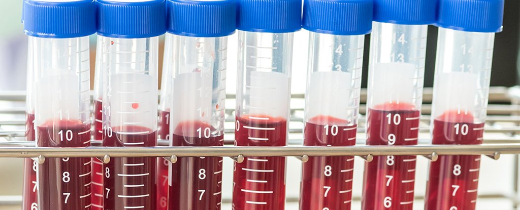 A Single Drop of Blood Could Soon Reveal Your Risk of Developing MS : ScienceAlert