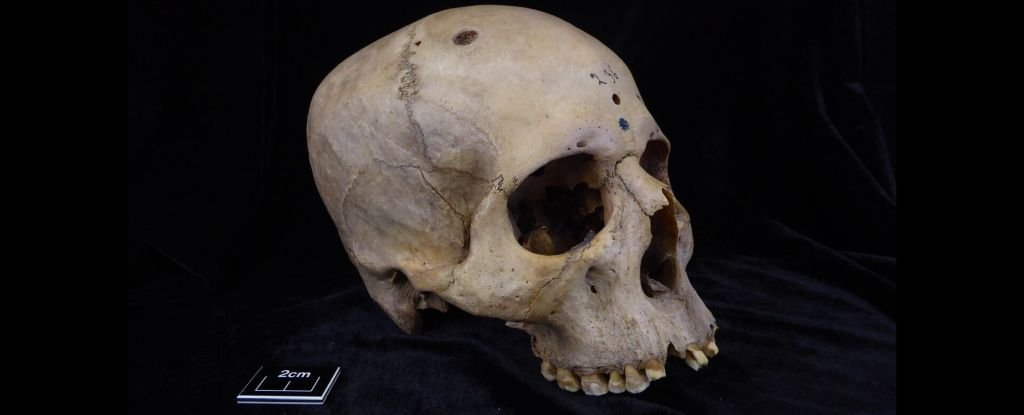 Ancient Egyptian Skull Found Riddled With Tiny Cut Marks This Could Be Why ScienceAlert