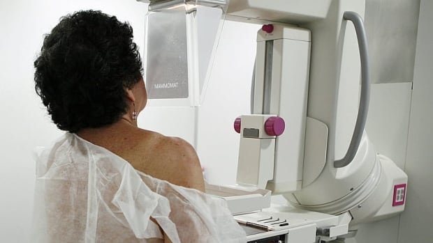 Breast screening at age 40 not routinely advised Canadian task force says