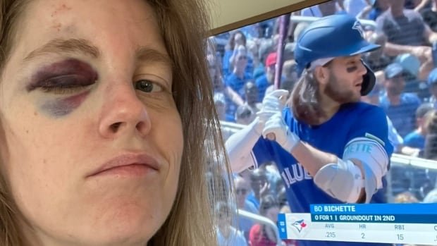 Jays fan hit in face by ball to get ball signed by Bo Bichette