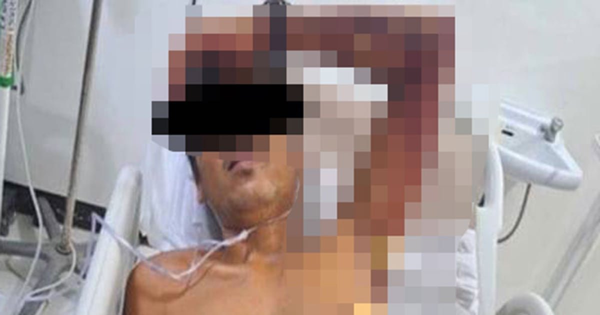 Man stabs rival who beat him in fistfight in Moalboal, Cebu