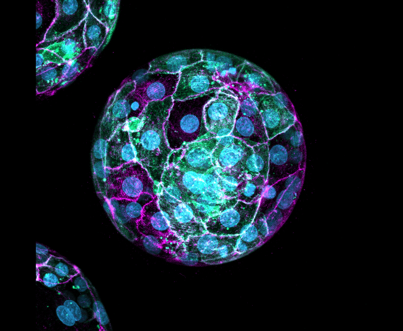 The First Two Cells in a Human Embryo Contribute Disproportionately to Fetal Development