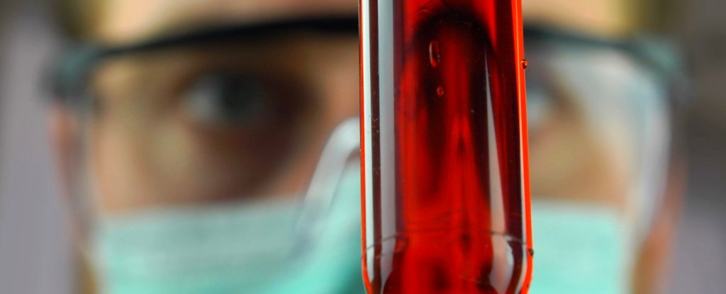 This New Blood Test Could Help Solve The Mystery of Multiple Sclerosis : ScienceAlert