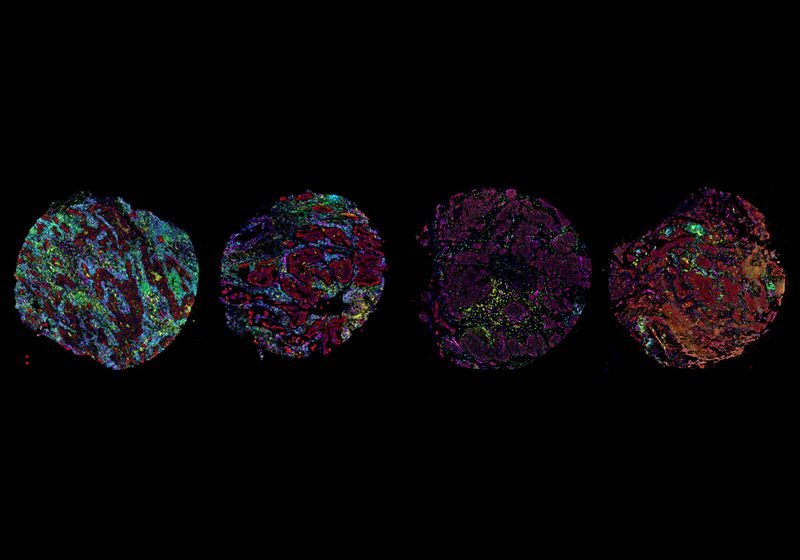 A Bird’s Eye View of the Tumor Microenvironment