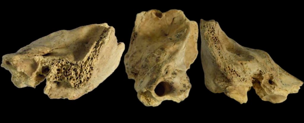 Fossilized Bone of Neanderthal With ‘Down Syndrome’ Challenges Ideas of Prehistoric Care : ScienceAlert