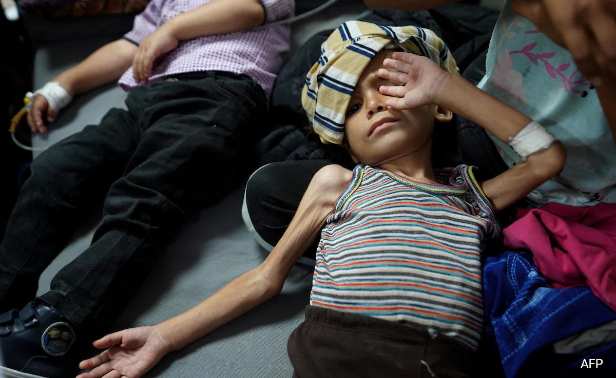 Over 8000 Children Aged Under 5 Treated For Acute Malnutrition In Gaza WHO