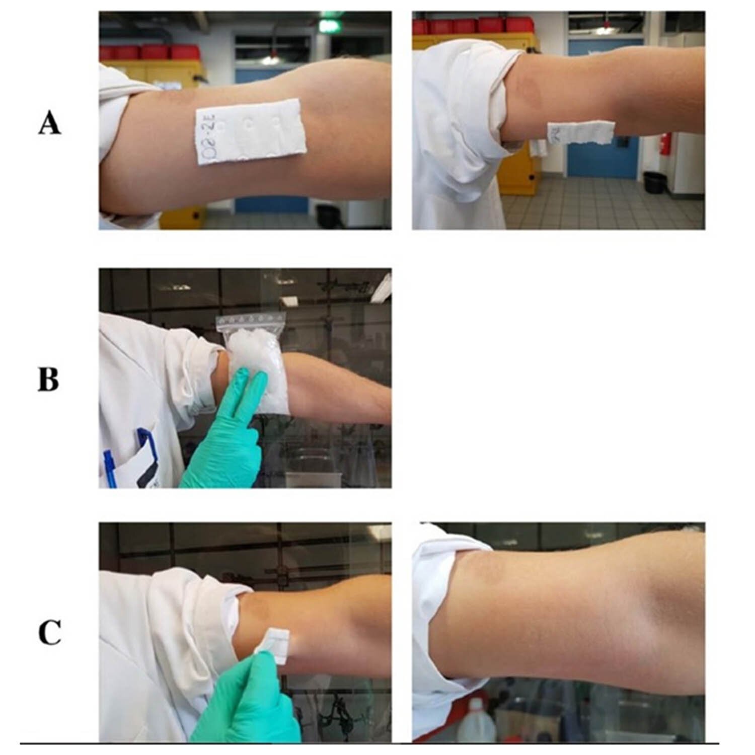 Researchers create innovative polymer wound dressings for painless and residue-free removal