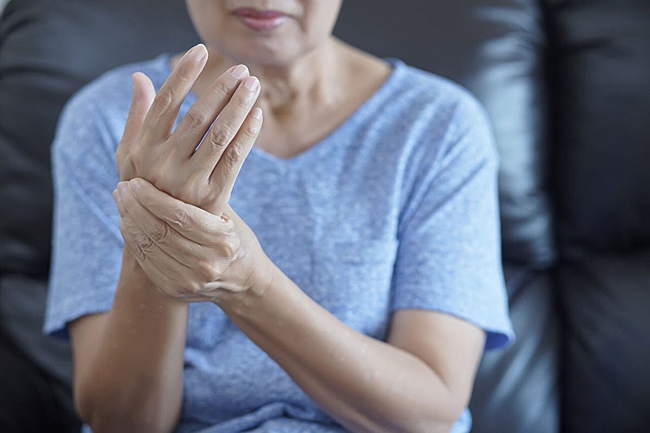 Rheumatoid arthritis patients with mono-, oligo-arthritis, high PGA remain most fatigued
