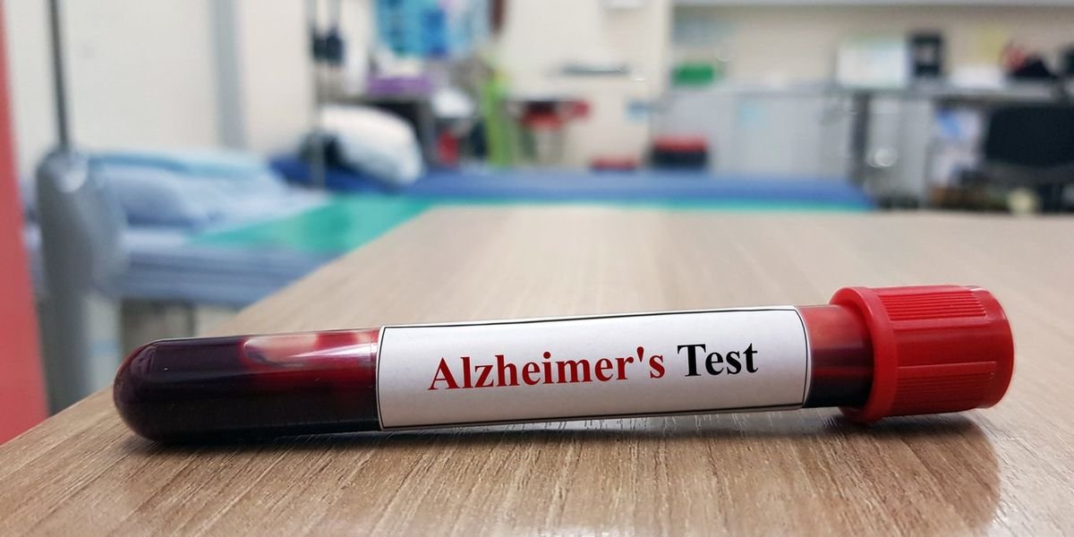 Should You Get an Alzheimer’s Blood Test?