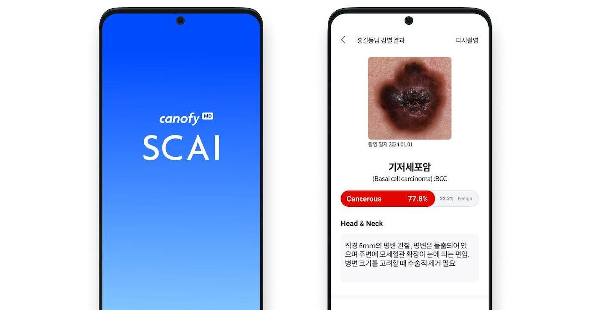 South Korea approves first local skin cancer detection AI