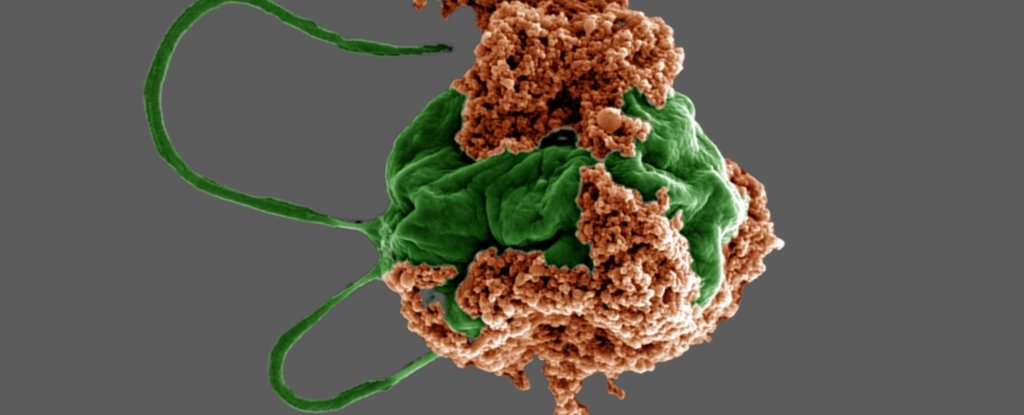Tiny Algae Microrobots Could Transform Lung Cancer Treatment : ScienceAlert