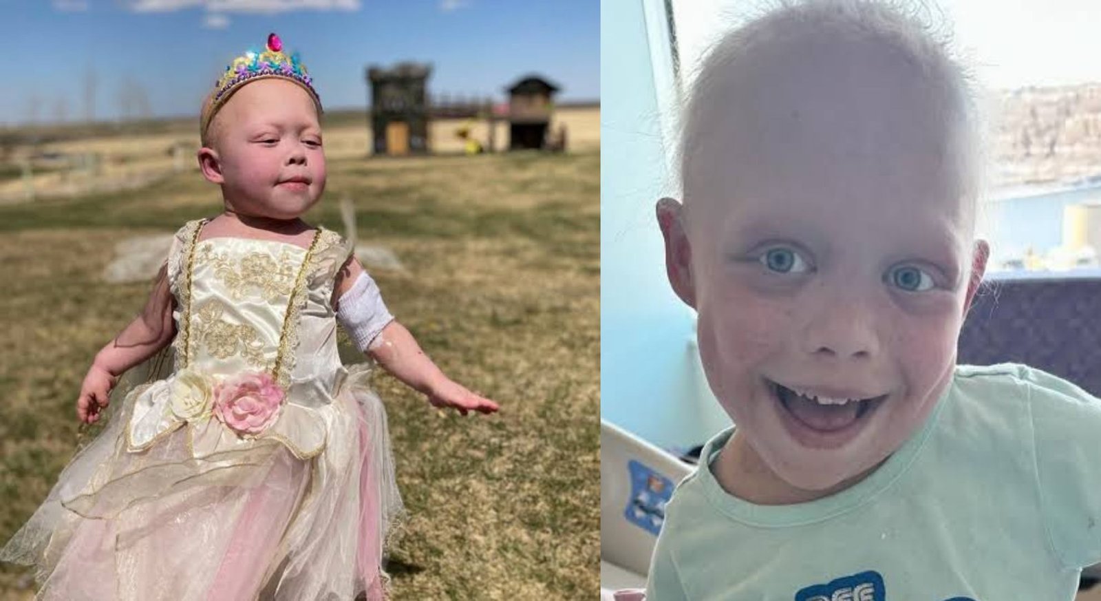TikTok sensation Bella Brave passes away at 10, days after being placed in medically induced coma
