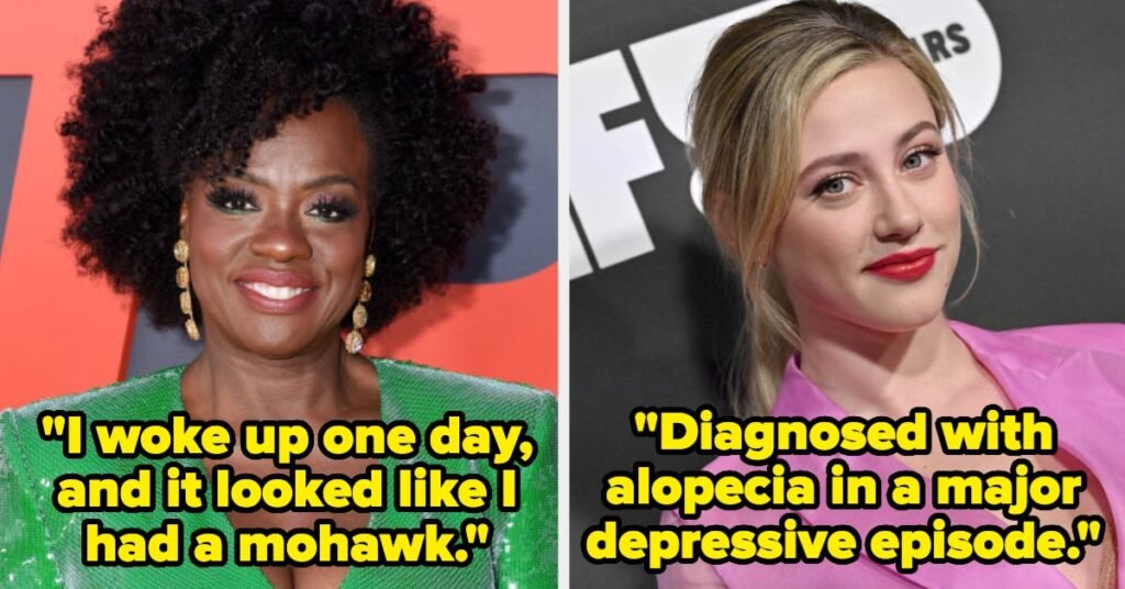 13 Celebrity Women Who Opened Up About Hair Loss