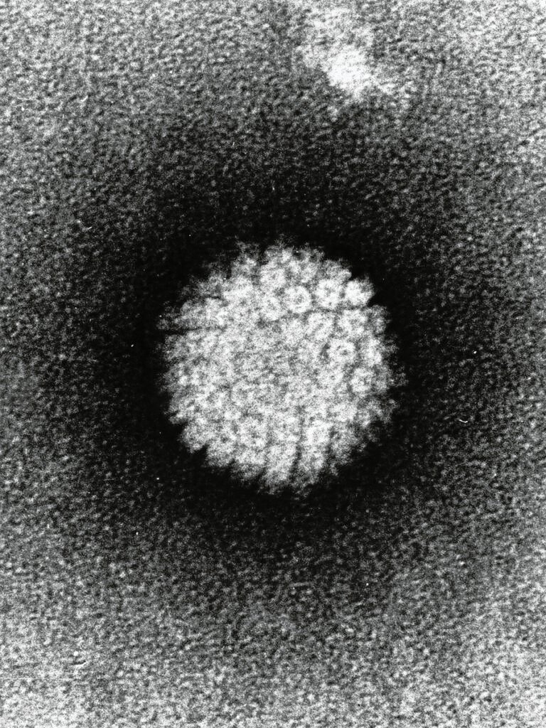 Men infected with high-risk types of HPV could struggle with fertility