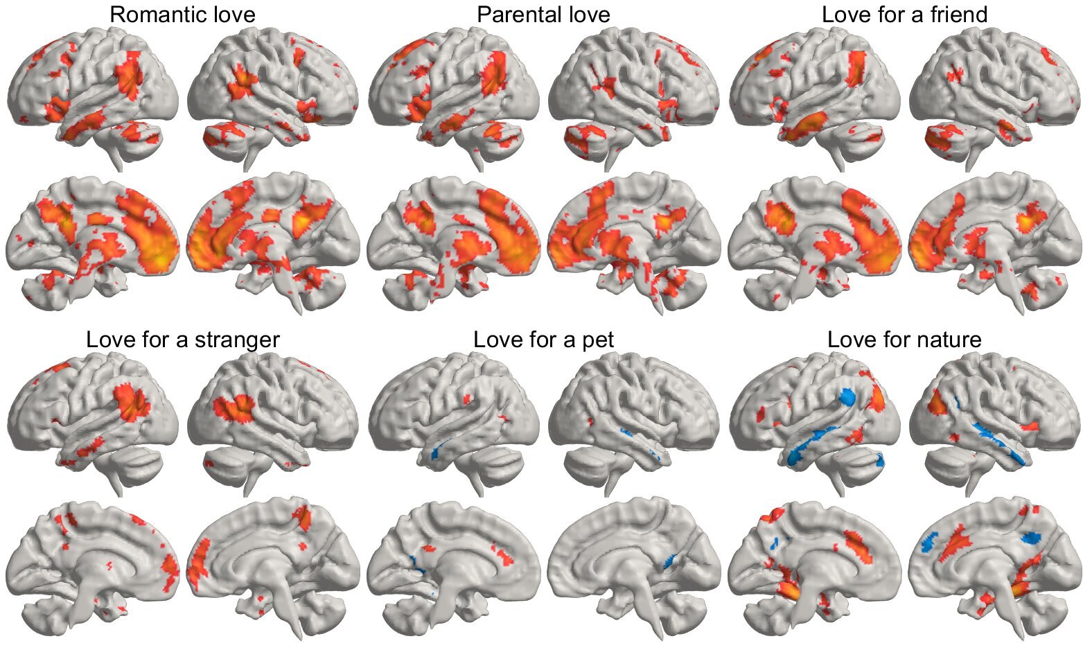 Study reveals where love lives in the brain