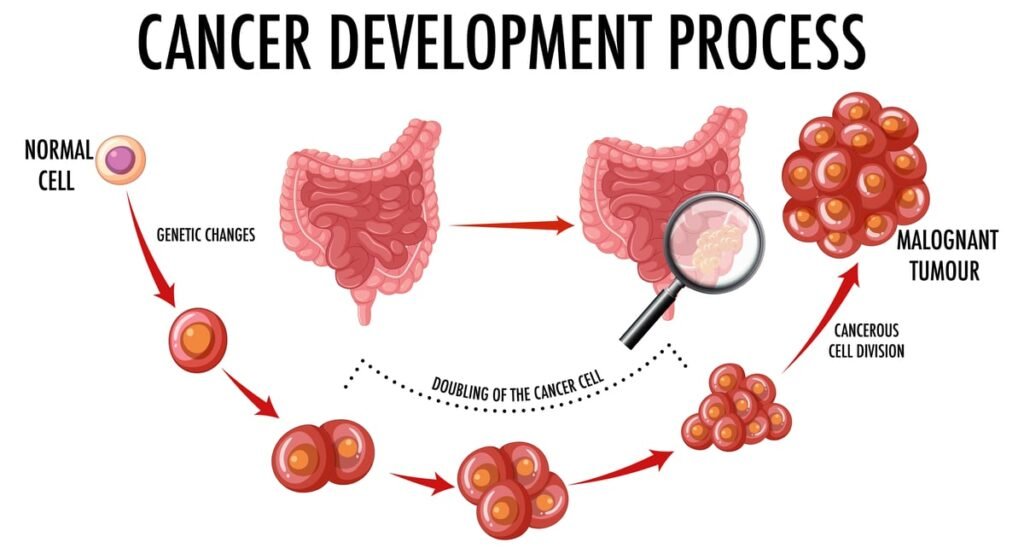 Why is there rise in color cancer in young people (Part 2)