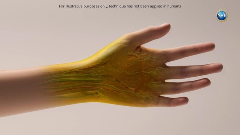 Transparent Arm