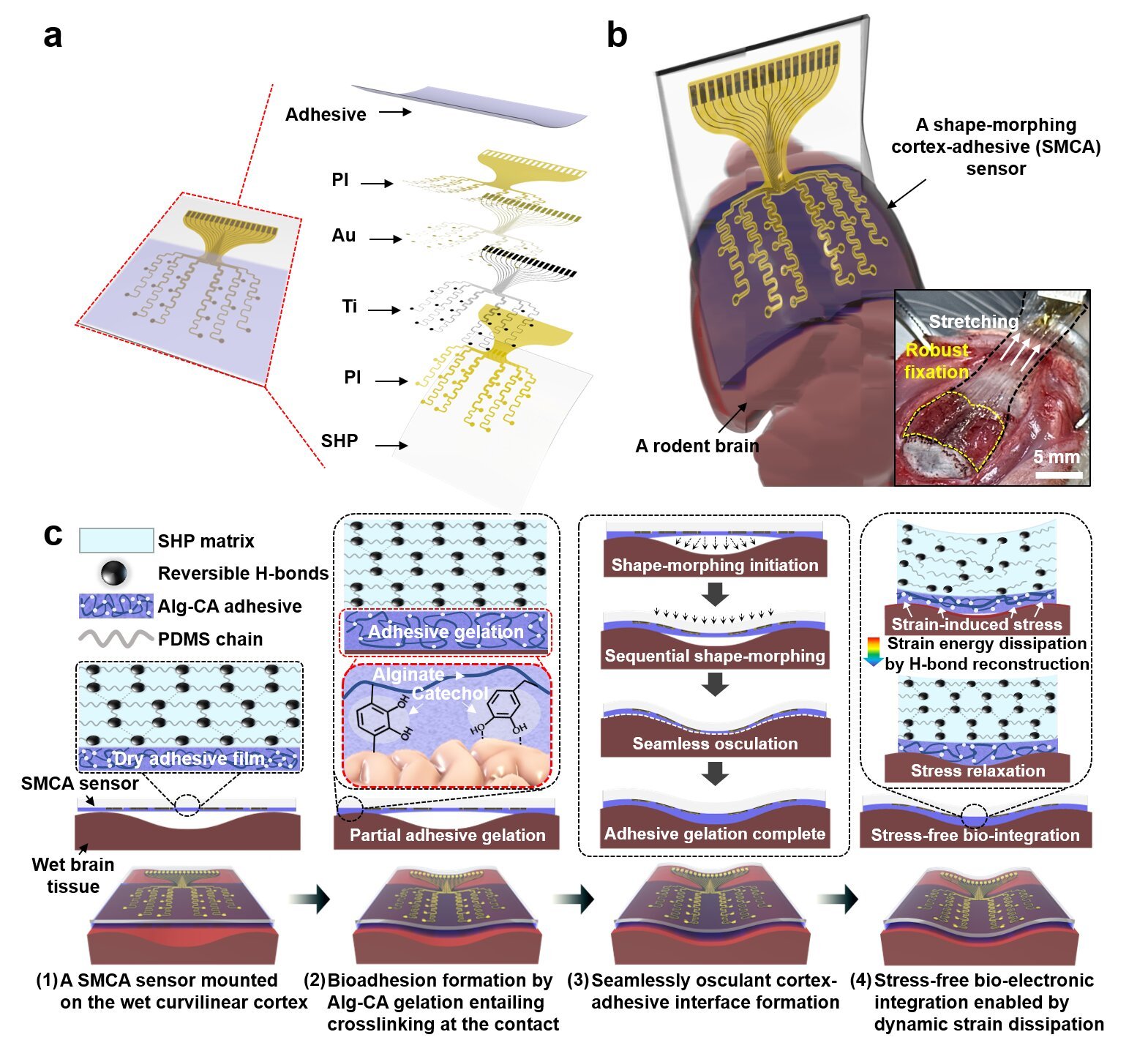 Adhesive cortical device enables artifact-free neuromodulation for closed-loop epilepsy treatment