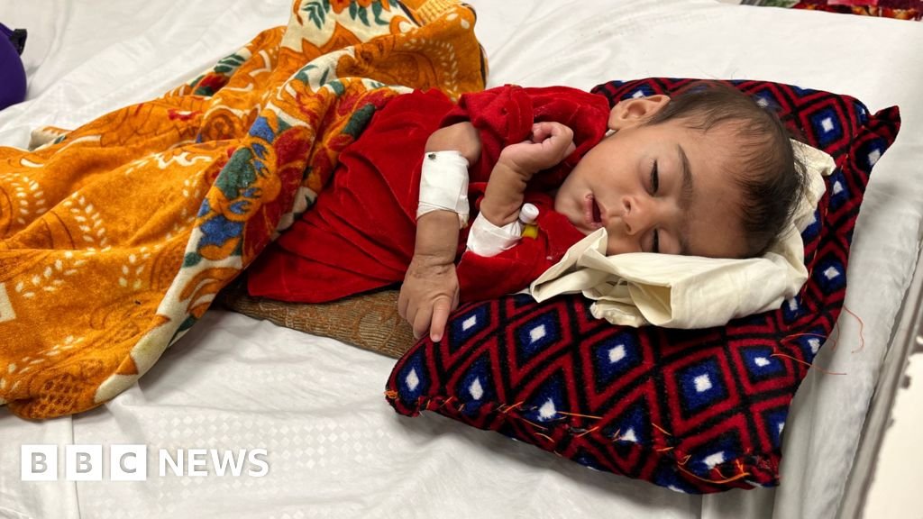 Babies dying as malnutrition disaster unfolds