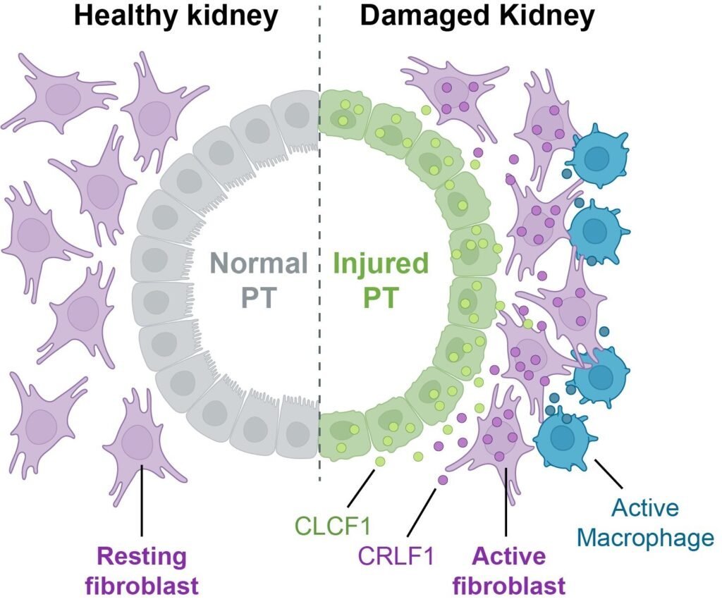 New study shows cells get involved in unhealthy relationships after acute kidney injury in mice