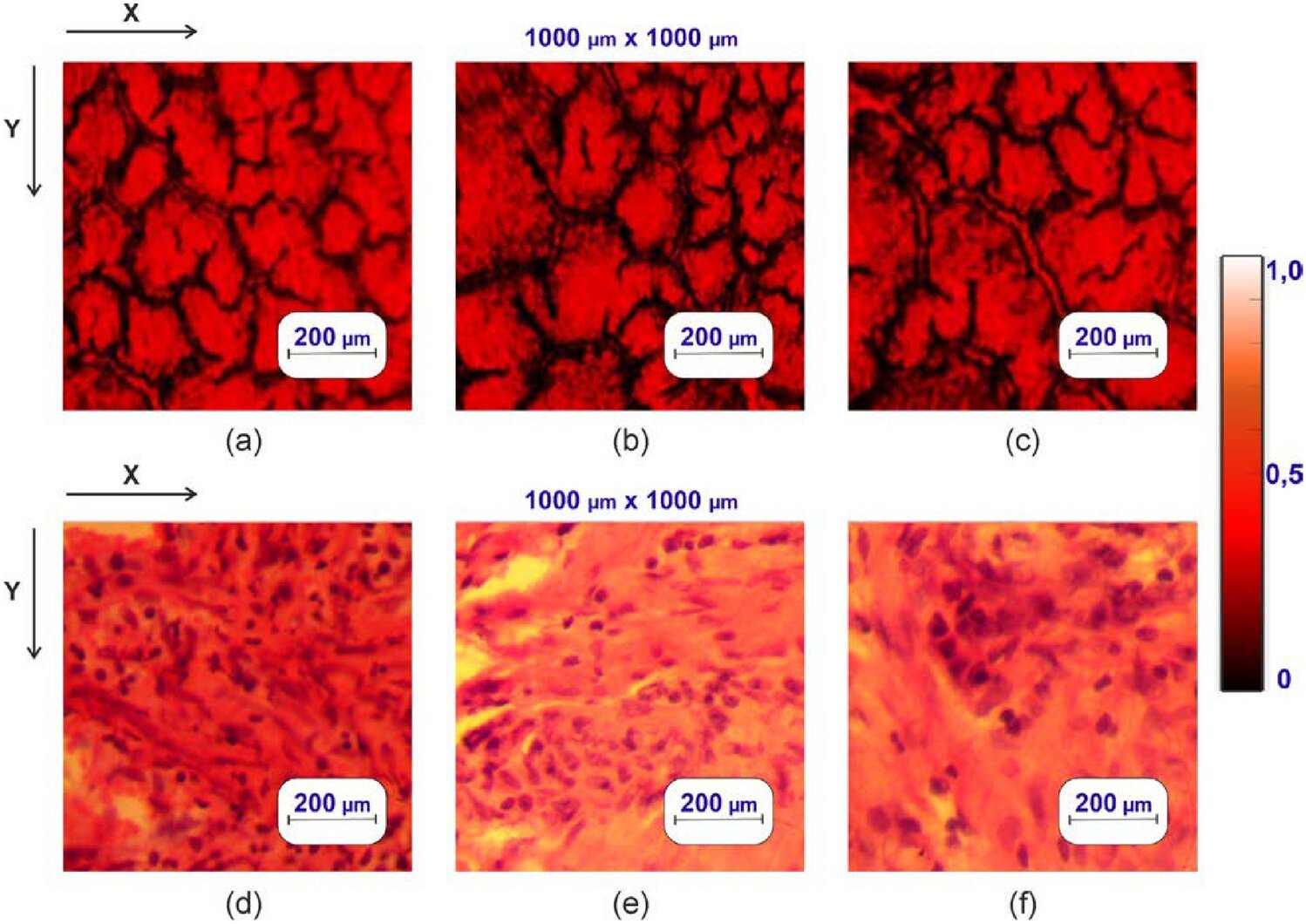 Novel light-based technique shows 90% accuracy in early prostate cancer detection