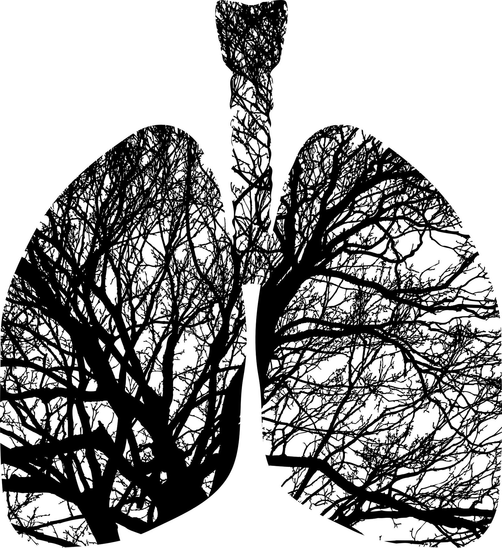 PanCan nodule management protocol found more effective than LungRADSv1.1 method