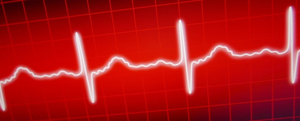 Position of Defibrillator Pads Makes a Huge Difference to Restarting Hearts : ScienceAlert